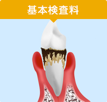 基本検査料