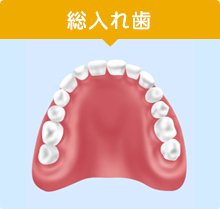 総入れ歯
