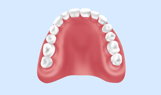全部床義歯